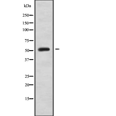 Polyclonal Rabbit anti-Human SLC16A7 / MCT2 Antibody (WB)