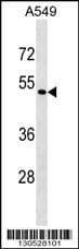 Polyclonal Rabbit anti-Human EIF2S3 / EIF2G Antibody (aa 273-299, Internal, WB)