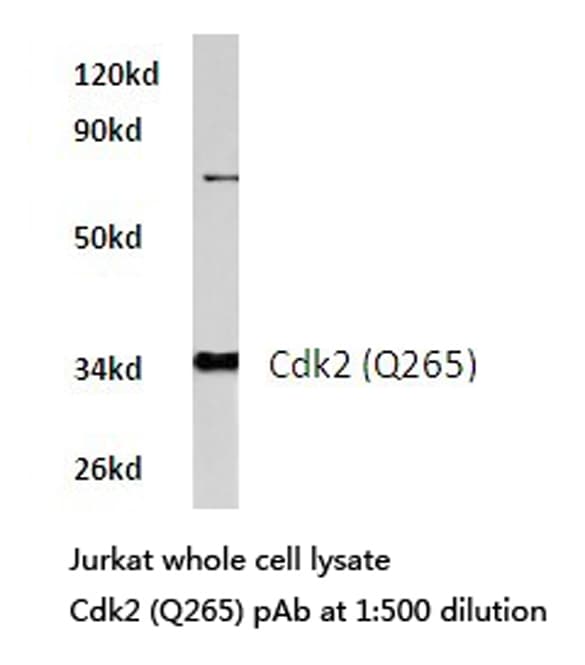 Polyclonal Rabbit anti-Human CDK2 Antibody (Gln265, IHC, WB)