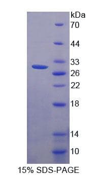 Human WDR90 Protein (Recombinant His-T7, N-terminus)