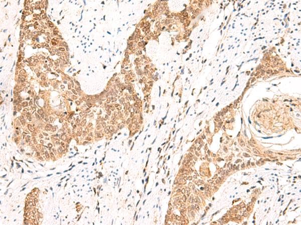Polyclonal Rabbit anti-Human PPP1R3C / PTG Antibody (IHC)