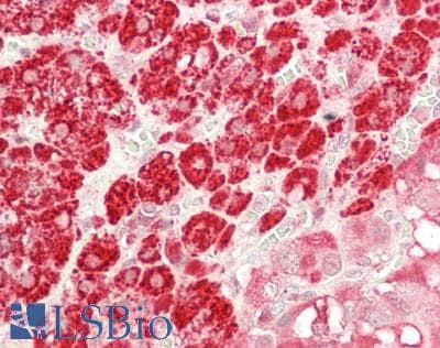 IHC-plus™ Polyclonal Rabbit anti-Human P450SCC / CYP11A1 Antibody (aa40-521, IHC, WB)
