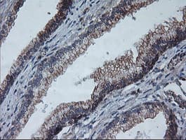 COPD / ARCN1 Antibody (clone OTI4H9)