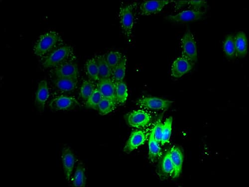 IHC-plus™ SCAMP3 Antibody (aa2-170)
