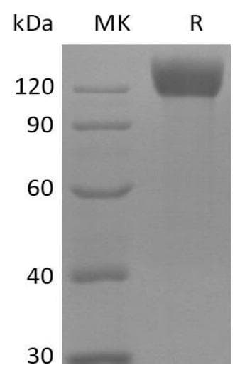 Mouse ANPEP / CD13 Protein (Recombinant 6His, C-terminus)
