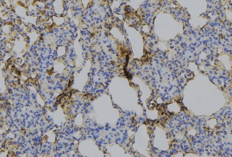 Mannose Receptor / CD206 Antibody