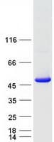 Human TBC1D13 Protein (Recombinant Myc-DDK (Flag))