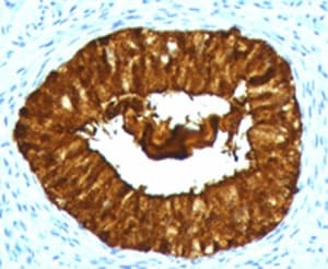MAML3 / CAGH3 Antibody (clone MMLP3-1)