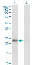 MAD2L1 / MAD2 Antibody (clone 2E2-1D6)