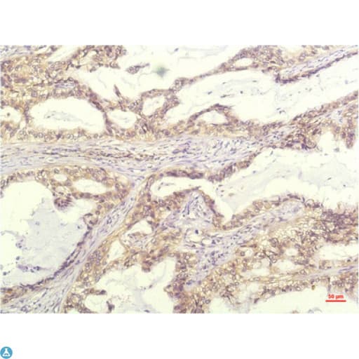 IL8 / Interleukin 8 Antibody