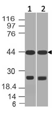 Polyclonal Rabbit anti-Human AP3M1 Antibody (WB)