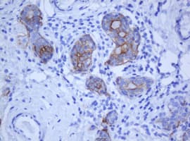 Monoclonal Mouse anti-Human KRT5 / CK5 / Cytokeratin 5 Antibody (clone OTI1F8, IHC)