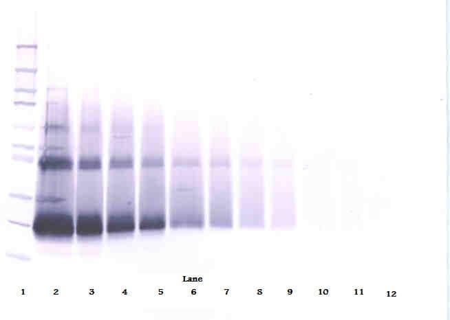 IFN Beta / Interferon Beta Antibody