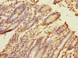 Polyclonal Rabbit anti-Human FRMD6 Antibody (IHC)