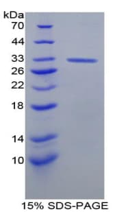 Rat DNA Topoisomerase II Protein (Recombinant His-T7)