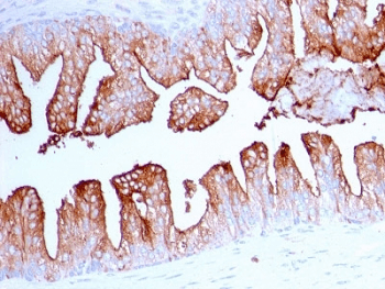 FOLH1 / PSMA Antibody (clone FOLH1/2363)