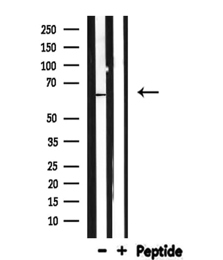 CALR / Calreticulin Antibody