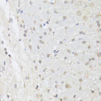 Polyclonal Rabbit anti-Human EP300 / p300 Antibody (IHC, WB)