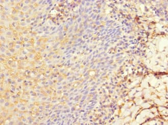 DEC-205 / CD205 / LY75 Antibody