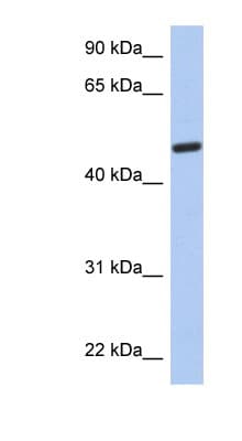CATIP / C2orf62 Antibody (N-Terminus)