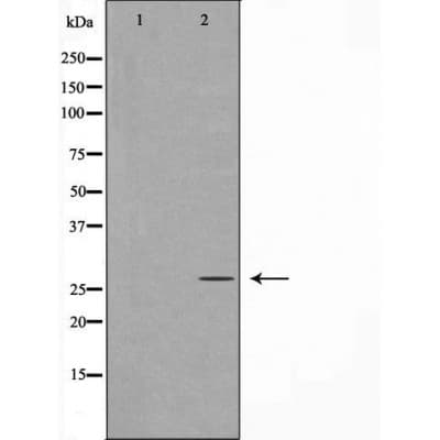 HOXA5 Antibody