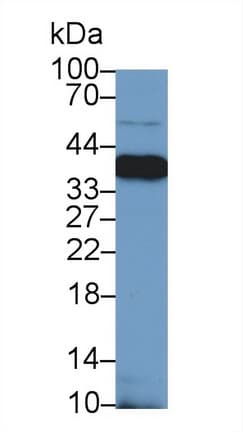 NPM1 / NPM / Nucleophosmin Antibody (aa20-154)