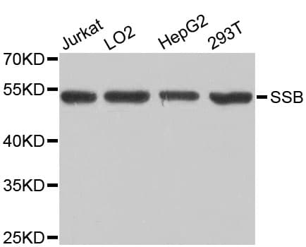 SSB / La Antibody