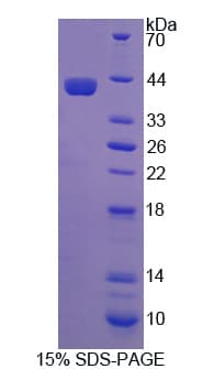 Human NCOA3 / SRC-3 / AIB1 Protein (Recombinant His-T7)