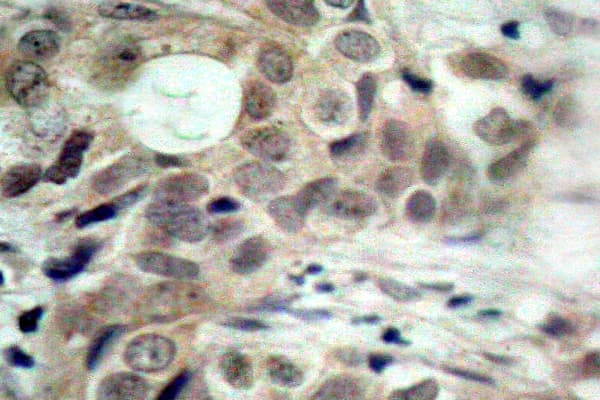 CDC25C Antibody (phospho-Ser216)