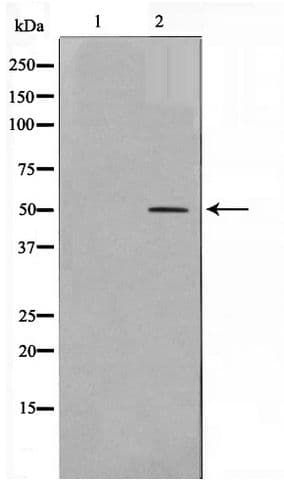 Polyclonal Rabbit anti-Human AKT1 + AKT2 + AKT3 Antibody (WB)
