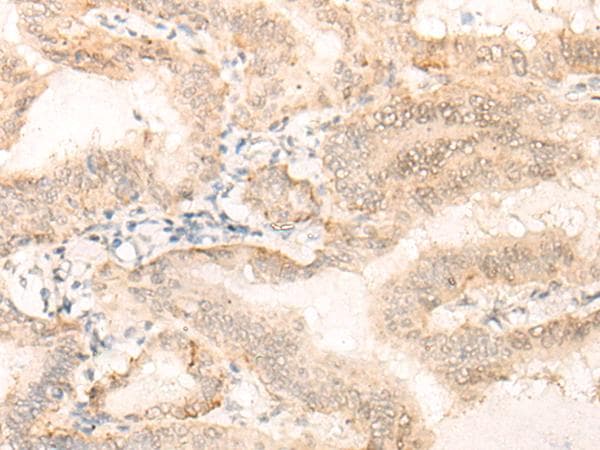 EIF4A3 Antibody