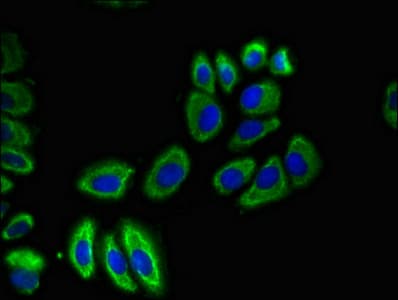 SLC12A7 / KCC4 Antibody