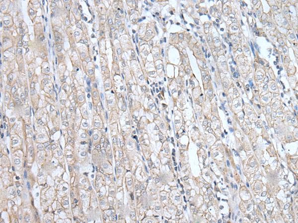 SPTA1 / Alpha Spectrin Antibody