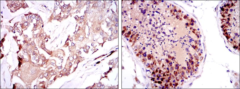 SMN1 Antibody (clone 5H1)