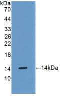 OSM / Oncostatin M Antibody (aa116-205)