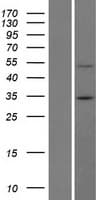 BTBD7 Protein (Over-Expression Lysate Myc-DDK (Flag))
