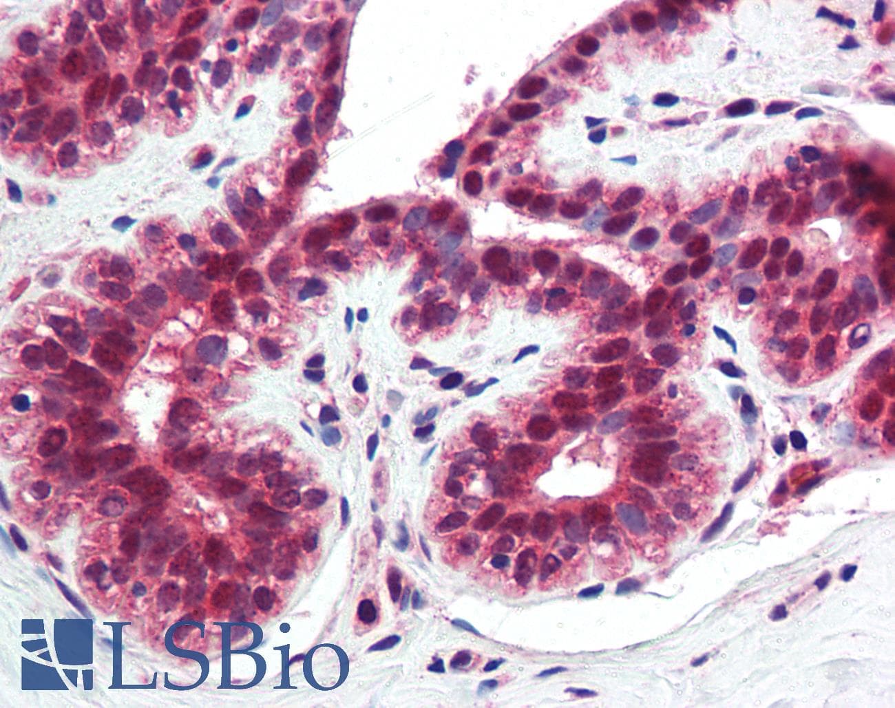 IHC-plus™ TNFRSF10A / DR4 Antibody (clone 32A1380)