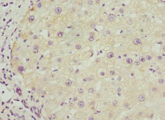 Polyclonal Rabbit anti-Human BAAT / BAT Antibody (IHC, WB)
