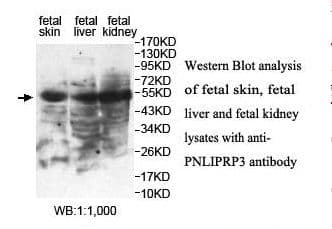 PNLIPRP3 Antibody (aa186-370)