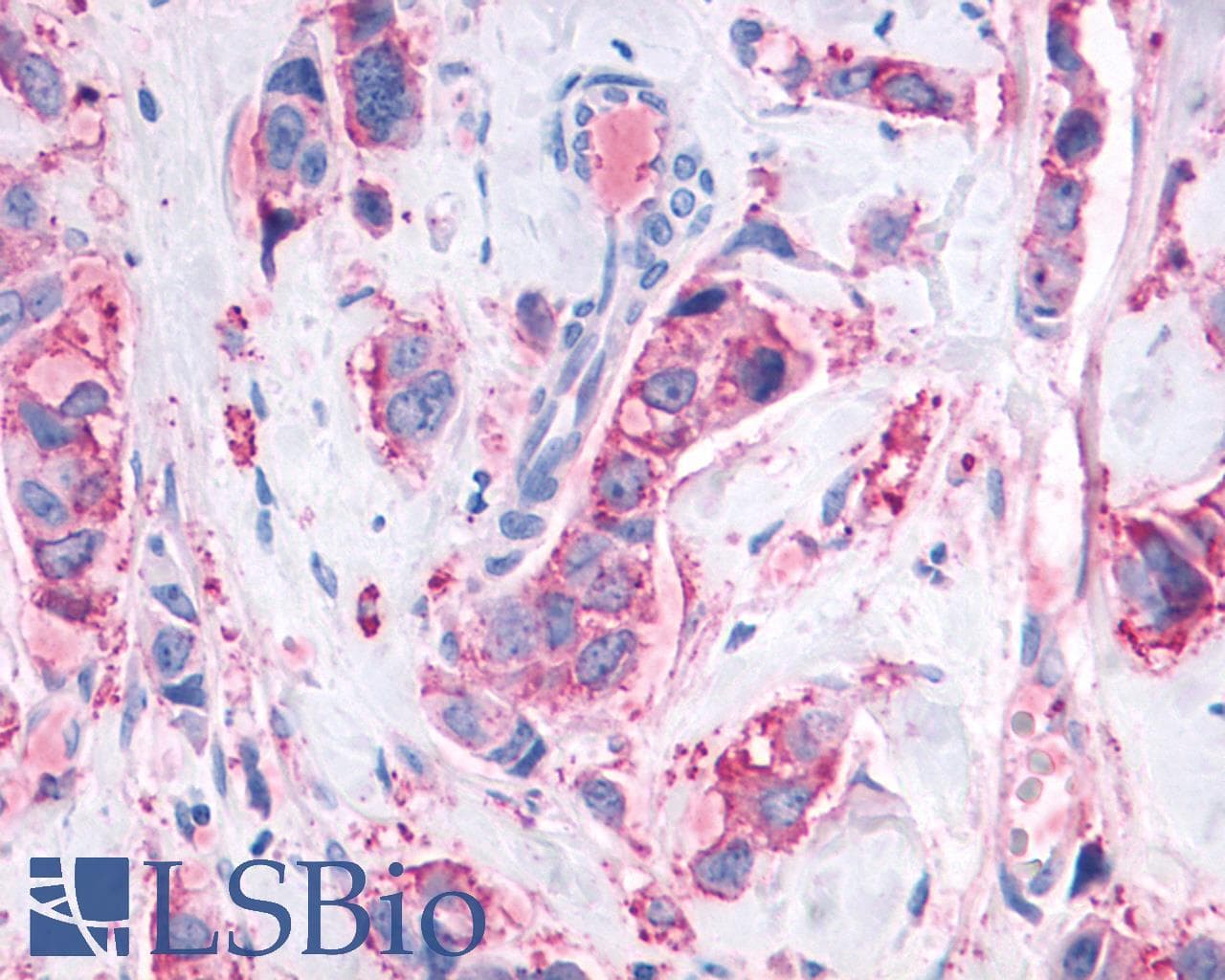 PathPlus™ MAS1 / MAS Antibody (Cytoplasmic Domain)