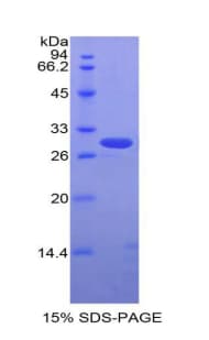 Rabbit ALCAM / CD166 Protein (Recombinant His)