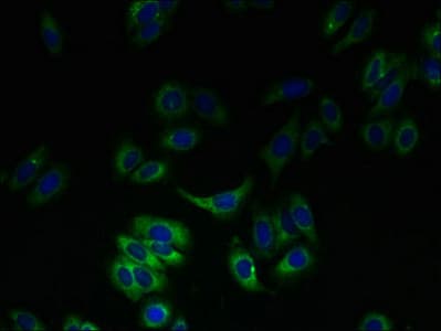 Polyclonal Rabbit anti-Human SLC23A3 Antibody (IHC)