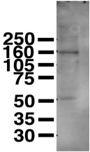 Monoclonal Mouse anti-Human WC1 / ATP7B Antibody (clone S62-29, IHC, WB)