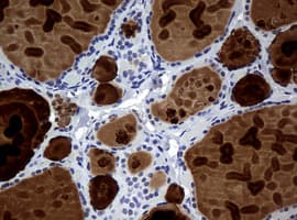 WFDC2 / HE4 Antibody (aa31-124, clone OTI2A7, Carrier-free)