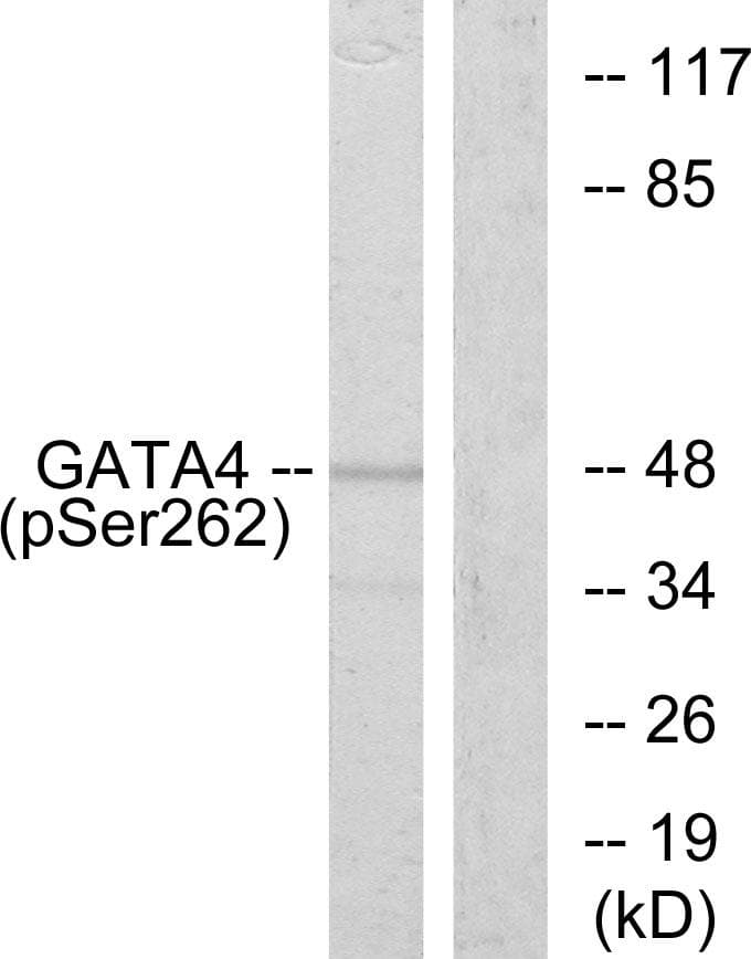 Polyclonal Rabbit anti-Human GATA4 Antibody (phospho-Ser262, IF, WB)