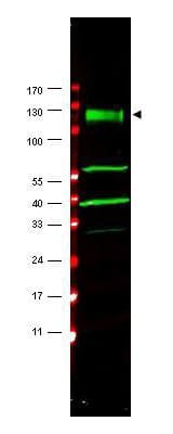IHC-plus™ FANCA Antibody