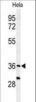 SUMF1 Antibody (aa303-331)
