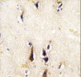 BACE1 / BACE Antibody (aa38-70)