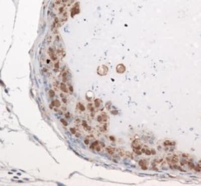 EXOSC9 / p5 Antibody