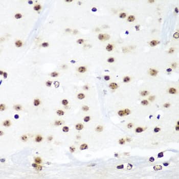 Polyclonal Rabbit anti-Human HTATSF1 / TAT-SF1 Antibody (IHC, WB)